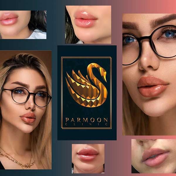 مدل های تزریق ژل لب