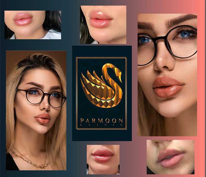 مدل های تزریق ژل لب