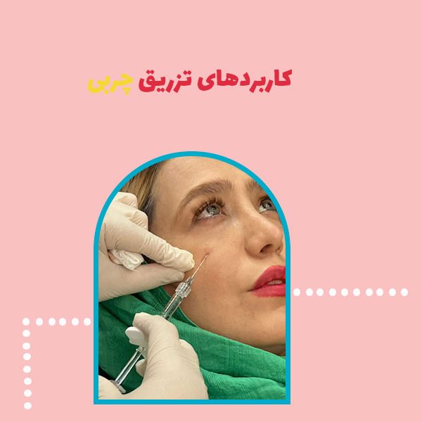 کاربردهای تزریق چربی