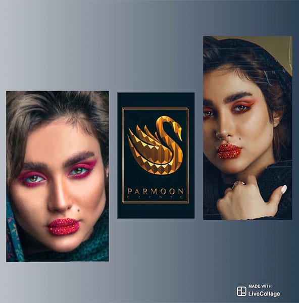 gel8 تزریق ژل و بوتاکس در بندرعباس